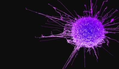 c0462719-cervical_cancer_cell_sem-spl